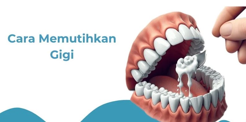 cara memutihkan gigi